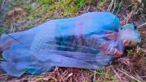 পলিথিনে মোড়ানো অ্যাসিডদগ্ধ এক নারী।