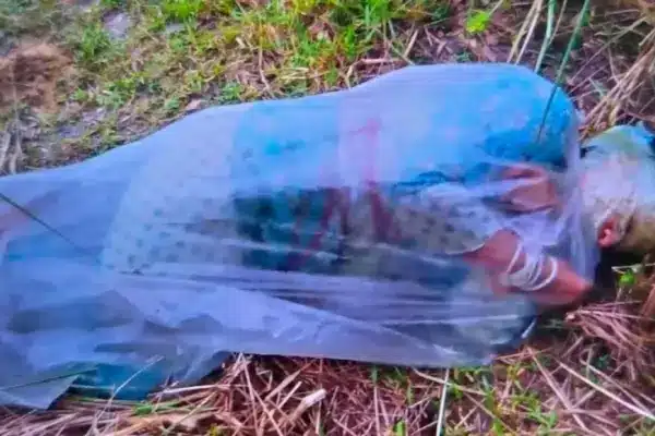পলিথিনে মোড়ানো অ্যাসিডদগ্ধ এক নারী।