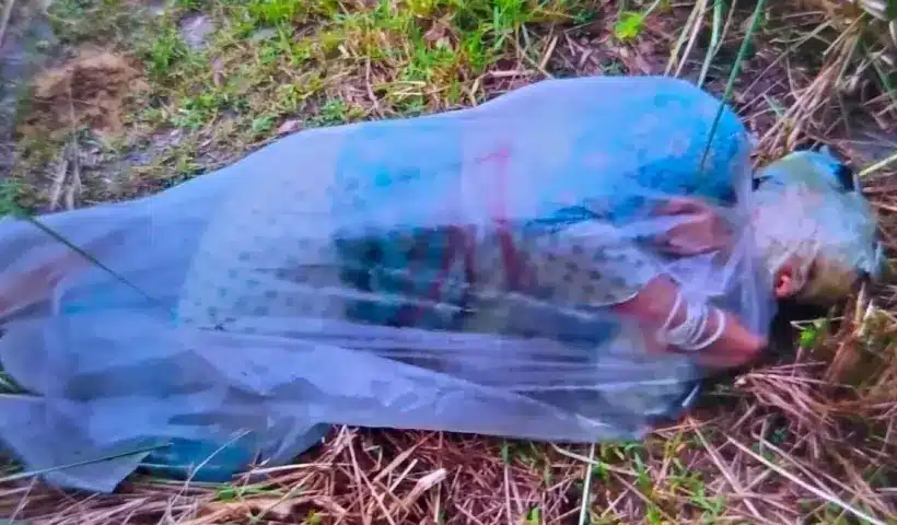 পলিথিনে মোড়ানো অ্যাসিডদগ্ধ এক নারী।