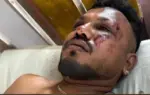 ভয়াবহ বিমান দুর্ঘটনায় সবাইকে মৃত ঘোষণা করার কয়েক ঘণ্টা পর এক চমকপ্রদ ঘটনা ঘটেছে।