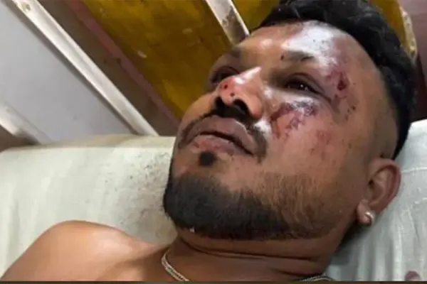 বিমান দুর্ঘটনায় বেঁচে গেলেন এক যাত্রী ভয়াবহ বিমান দুর্ঘটনায় সবাইকে মৃত ঘোষণা করার কয়েক ঘণ্টা পর এক চমকপ্রদ ঘটনা ঘটেছে।