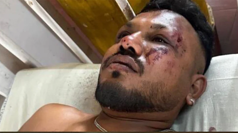 ভয়াবহ বিমান দুর্ঘটনায় সবাইকে মৃত ঘোষণা করার কয়েক ঘণ্টা পর এক চমকপ্রদ ঘটনা ঘটেছে।
