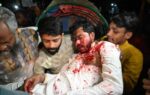 পুলিশ এবং সেনাবাহিনীর যৌথ হামলার পর নুরুল হক নুর রক্তাক্ত এবং মারাত্মক আহত হওয়ার পর তার সহযোগীরা তাকে কোলে করে হাসপাতালে নিয়ে যাচ্ছেন।