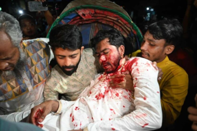 পুলিশ এবং সেনাবাহিনীর যৌথ হামলার পর নুরুল হক নুর রক্তাক্ত এবং মারাত্মক আহত হওয়ার পর তার সহযোগীরা তাকে কোলে করে হাসপাতালে নিয়ে যাচ্ছেন।