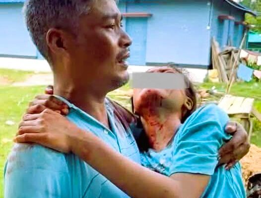 খাগড়াছড়িতে পাশবিক নির্যাতনের শিকার মেয়েকে কোলে নিয়ে কাঁদতে কাঁদতে হেঁটে যাচ্ছেন অসহায় পিতা।