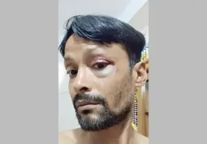 জুলাই শহীদ স্মৃতি ফাউন্ডেশনে নির্যাতনের অভিযোগ করেছেন কয়েকজন।