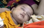 হামের উপসর্গ নিয়ে হাসপাতালে ভর্তি এক শিশু।